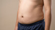 © Mike Stock - Man with stomach discomfort, hands pressing on belly. Symbolizes bloating, indigestion, and abdominal pain in adults.