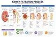 © Jafree - Kidney filtration process infographic showing nephron anatomy and step by step urine formation. Medical biology illustration for education about renal function, blood purification and human organ