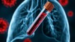 © Suleyman - Blood tube tests for hantavirus sickness in lungs.