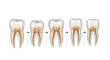 © Sajahan - Sequential dental diagram showing stages of tooth decay from healthy enamel to deep infection and cavity formation.