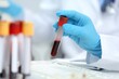 © kardaska - Hand holding blood sample analyzing medical test tube