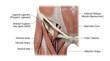 © huyelah - Medical illustration of human inguinal region anatomy with labeled structures