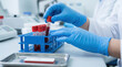 © Taras Roshchuk - A laboratory technician in gloves picks up a blood sample tube from a rack. The setting is a testing area designed for medical examinations. Equipment is visible in the background