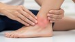 © Djemari - A person's hand gently touching a red, swollen, and painful ankle, indicating an injury or inflammation.