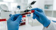 © Anjana444 - Scientist holding blood test tube in laboratory for medical research analysis