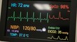 © Tro - Medical monitor displaying patient vital signs and waveforms.