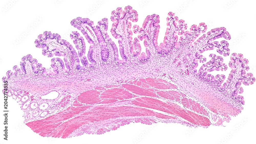 Histology photomicrograph of normal human gallbladder tissue stained ...