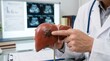 © AlfaSmart - Doctor holding a liver model with a tumor to explain diagnosis and treatment to a patient. Medical professional analyzing anatomy for clinical education and oncology consultation.