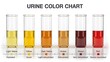 © millennium - Urine color hydration chart showing dehydration and health levels