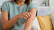 © ArtFocus Studio - Woman scratching itchy arm, closeup of irritated skin and dry dermatological condition at home