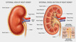 © Chaya - Anatomy of human kidney showing external view and internal cross section