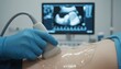 © Romilier - Healthcare professional performing an abdominal ultrasound on a pregnant patient. Close up of transducer with gel and sonogram monitor. Prenatal medical examination in a clinic