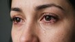 © Karan - Close-up portrait of crying woman with red irritated eyes and tears irritated distress close-up portrait depressed