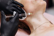© wedmoments.stock - Mesotherapy procedure performed on female patient by specialist in black gloves in clinical environment. Concept skincare, dermatology and beauty treatment.