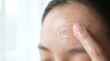 © Sugar Love Love - Woman applying gel moisturizer to healing acne on forehead