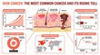 © Mosaic Mind - Skin cancer disease statistics chart with melanoma incidence and survival
