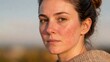 © sknab - Close-up portrait of young woman with natural skin redness and acne looking serious outdoors in soft light
