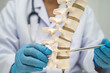 © amazing studio - Doctor holding osteoporosis in back bone model.