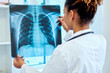 © DragonImages - Black female doctor examining chest X ray film in clinic, assessing lung health and diagnostic results. Ideal for healthcare, radiology, respiratory care, medical screening