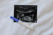 © Home-stock - Pregnancy test and fetal ultrasound photo on soft white bedding, representing early pregnancy, maternal health, fertility and anticipation of new family member