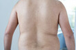 © Mihail - Back view of an overweight man showing love handles and lower back fat