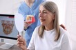 © New Africa - Woman looking at her teeth in mirror and doctor with dental implant model in clinic, closeup