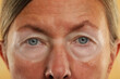 © New Africa - Mature woman with suntanned face and mark from sunglasses, closeup