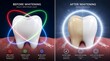 © TAJUL - Before and after teeth whitening comparison showing the difference in tooth