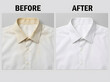 © ANMZAKARIA - How to remove yellow sweat stains from white shirt collars | Effective laundry whitening before and after comparison | Professional stain removal results for cotton dress shirts