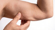 © GeniusMinus - Close-Up of Hand Pinching Loose Skin on Upper Arm