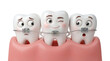 © nuralam_gfx - Funny cartoon teeth with metal braces in pink healthy gums isolated on transparent background