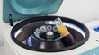 © Bounpaseuth - Centrifuge with Blood Sample: A laboratory centrifuge with a spinning rotor holds a test tube containing a blood sample, showcasing a scientific process for analysis and research.