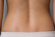 © onyip - Close up human back skin texture and lumbar curve