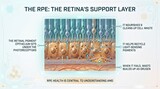The RPE the retinas support layer