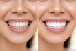 © Meow Creations - Close up of woman smile showing teeth whitening before and after comparison side by side