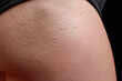 © JoeyMarut - Close up hip skin natural texture light skin tone small bumps subtle pores smooth flesh
