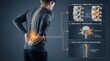 © MindsTock - Lumbar disc herniation medical illustration showing nerve root compression and sciatic nerve dermatome pathway, man with lower back pain and spinal injury