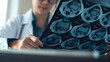 © tippapatt - Orthopedist doctor examining knee bone MRI scan film of senior patient at hospital or medical clinic. healthcare and medicine concept.