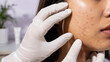 © Victoria - dermatologist examining woman cheek with acne and pigmentation. Dermatology consultation and skin problem diagnosis. Healthcare and cosmetology treatment concept