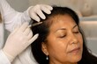 © arina.arti_ - Scalp PRP therapy hair growth treatment for mature Indigenous woman
