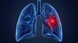 © abdul karim - Lung infection and respiratory disease medical illustration