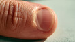 © lemonmoon - Adult thumb nail macro close up showing natural skin texture and rounded nail detail on pale linen surface in soft daylight