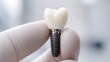 © Halina - Close up of single dental implant with ceramic crown held by dentist in sterile clinical environment for care