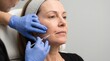© Gexun - Dermatologist giving facial injection treatment to a mature woman around the lip and cheek area in aesthetic medical clinic