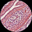© Jasmine - Microscopic view of human kidney tissue showing glomerulus and tubules scientific research medical study histology