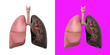 © ADPShapla - Anatomical human lung model showing healthy tissue and damaged infected lung section transparent background, png