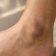 © Standasdp - closeup of dark pigmented ankle skin from another angle