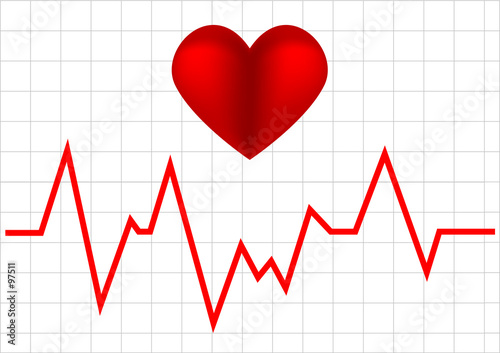 heart monitor graph