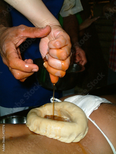 ayurvedic vasti treatment - close up
