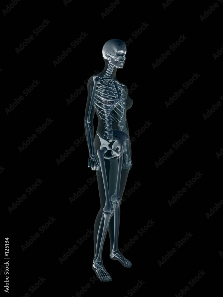 xray, x-ray of the human female body.